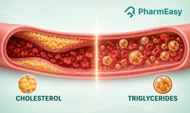 triglycerides vs cholesterol