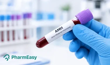 Anti Mullerian Hormone