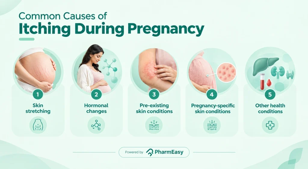 Common Causes of Itching During Pregnancy