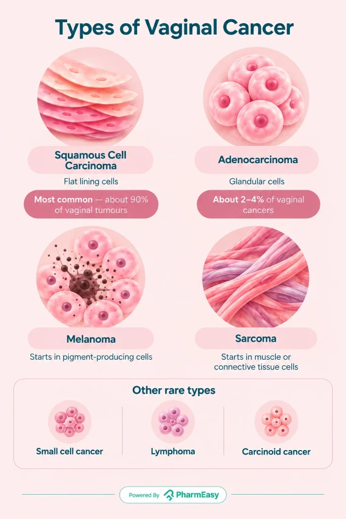 Types of Vaginal Cancer