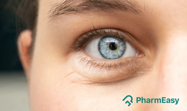 Eye Cancer: Symptoms, Causes, Types, Treatment & Prevention 
