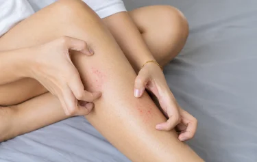 Avoid Irritating the Skin