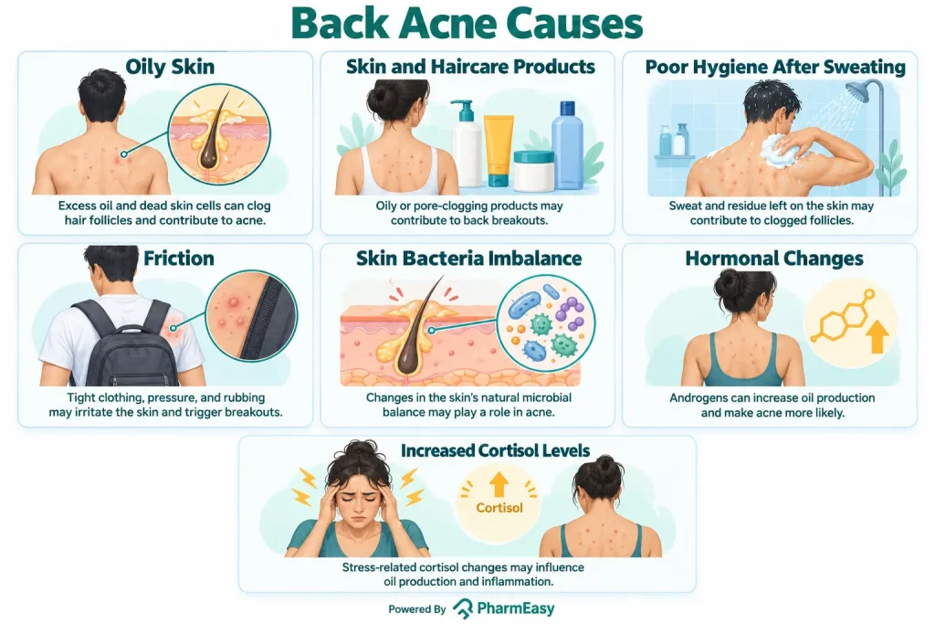 Back Acne Causes