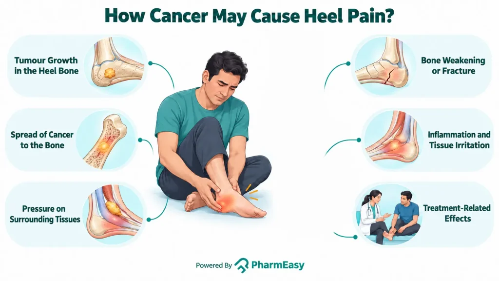 How Cancer May Cause Heel Pain