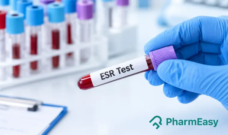 ESR Level in Cancer Patients: Normal Range, Causes, Diagnosis & Treatment