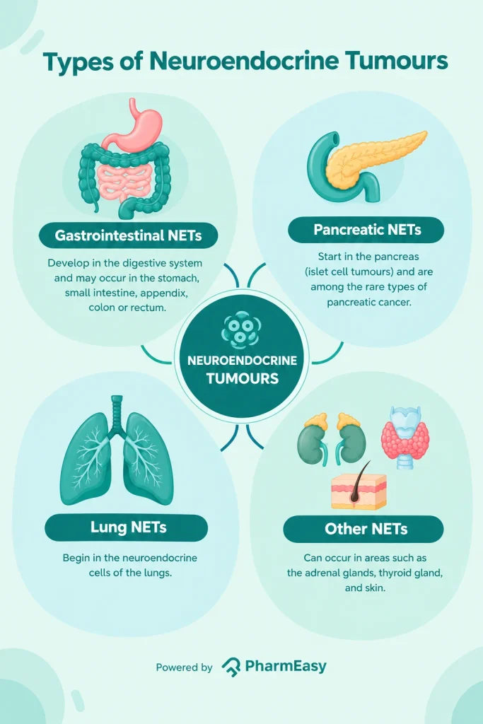 types of nets