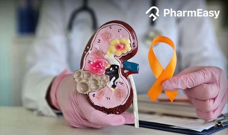 Kidney Cancer: Symptoms, Causes, Treatments & More!